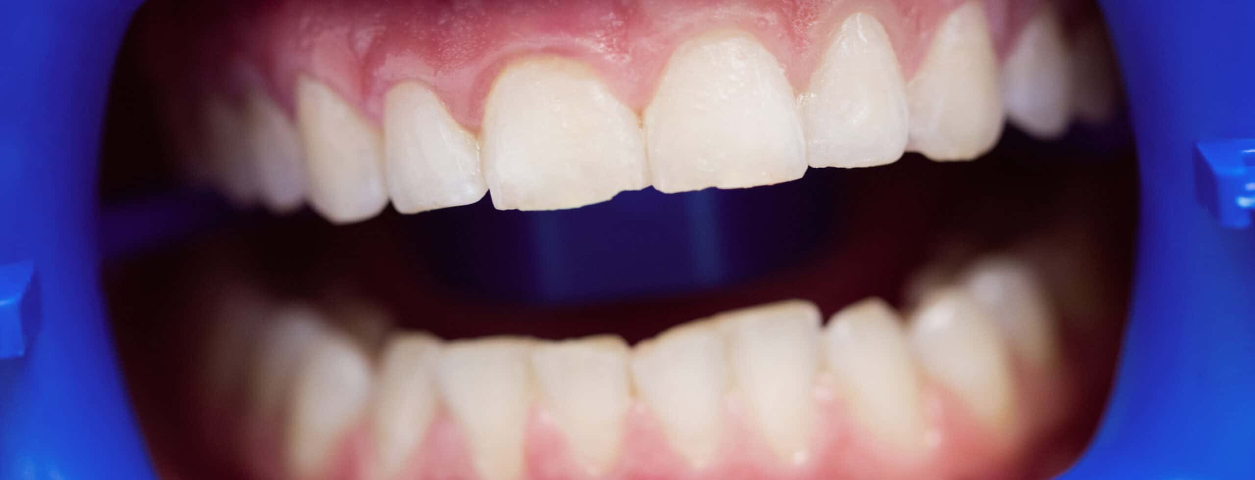 Registo fotográfico intraoral