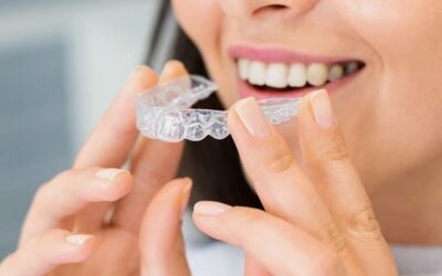 Aparelho invisível ou fixo: qual o melhor para alinhar os dentes?